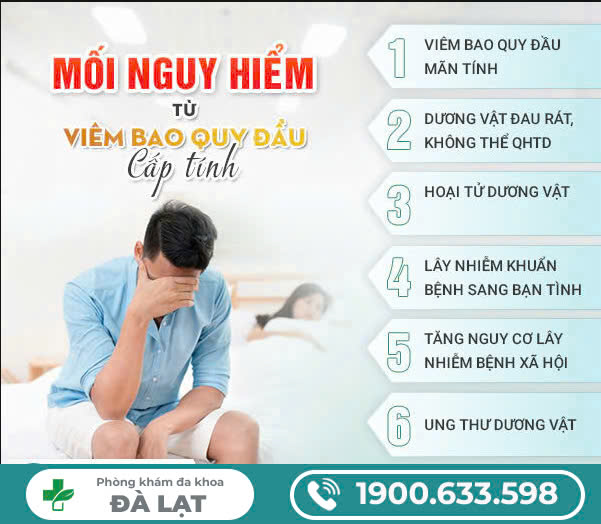 Hình ảnh minh họa